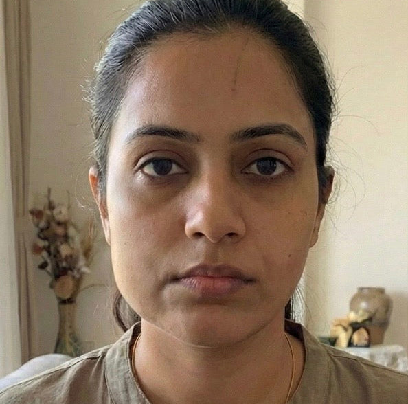 Understand your Face Then Fix it Correctly