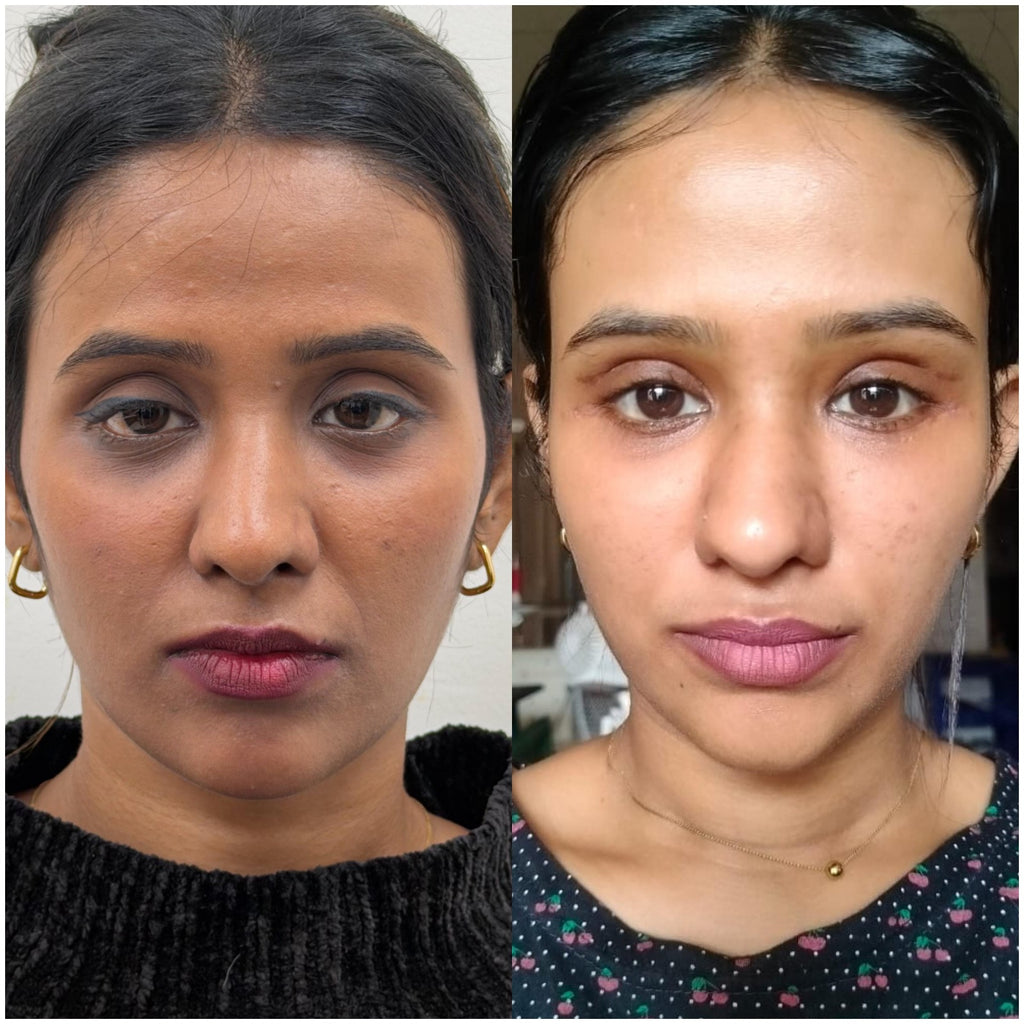 Understand your Face Then Fix it Correctly