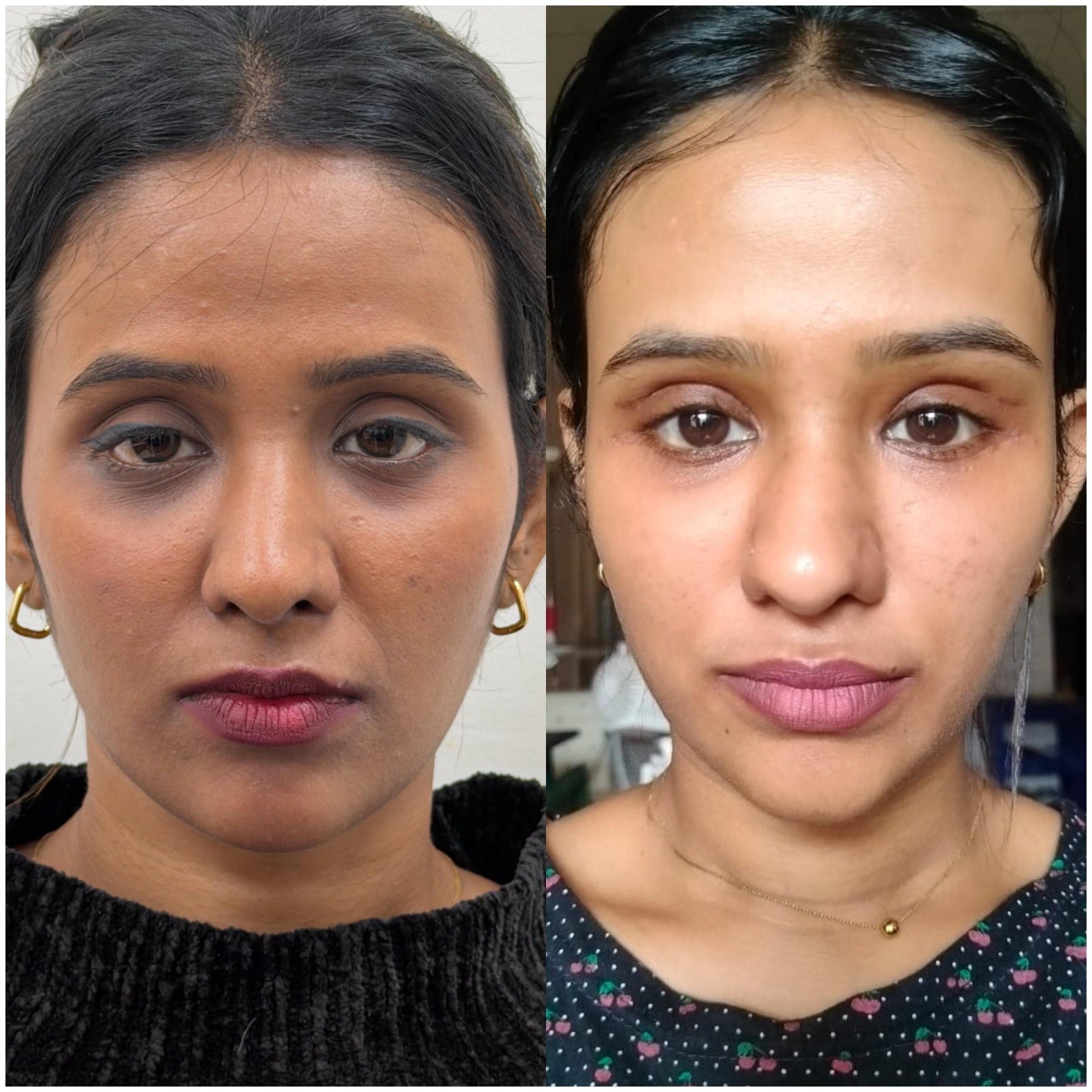 Understand your Face Then Fix it Correctly