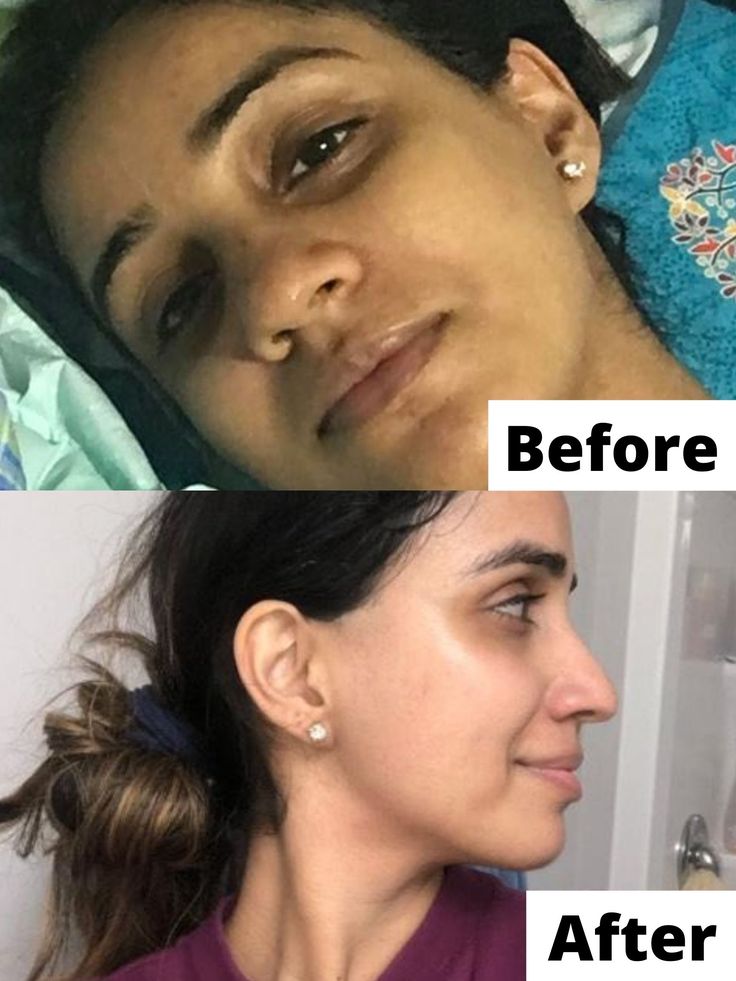 Understand your Face Then Fix it Correctly